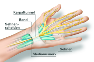 Die Hand - Grafik