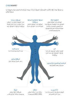 Einsatzfelder Cyberknife